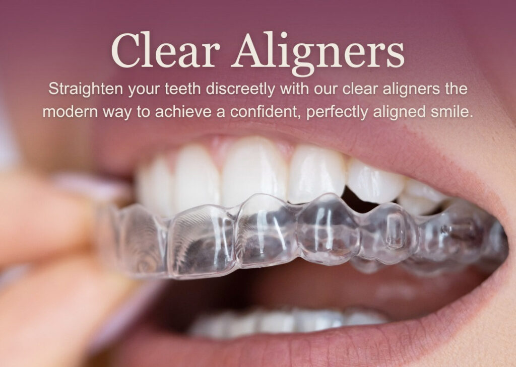 Clear aligners